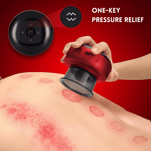 Electric Cupping Massager